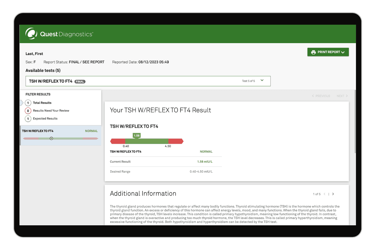 Thyroid TSH Function Test