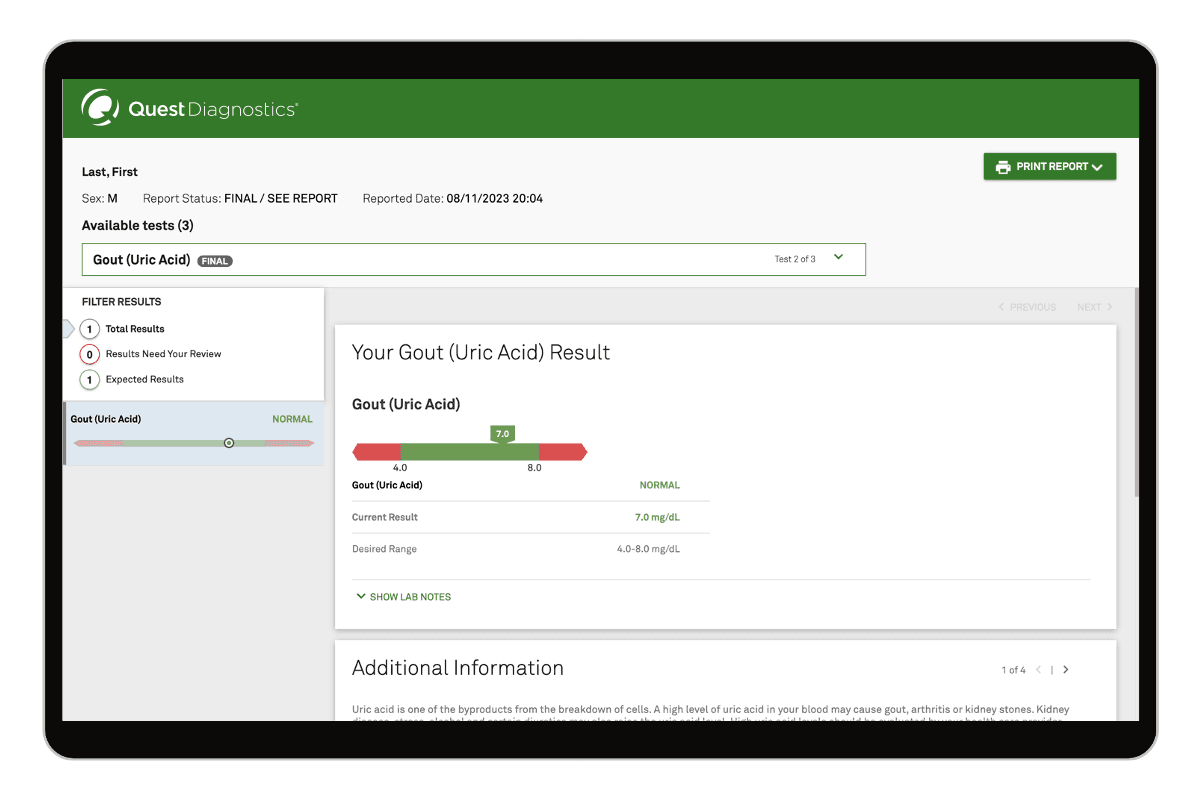 Gout (Uric Acid) Test