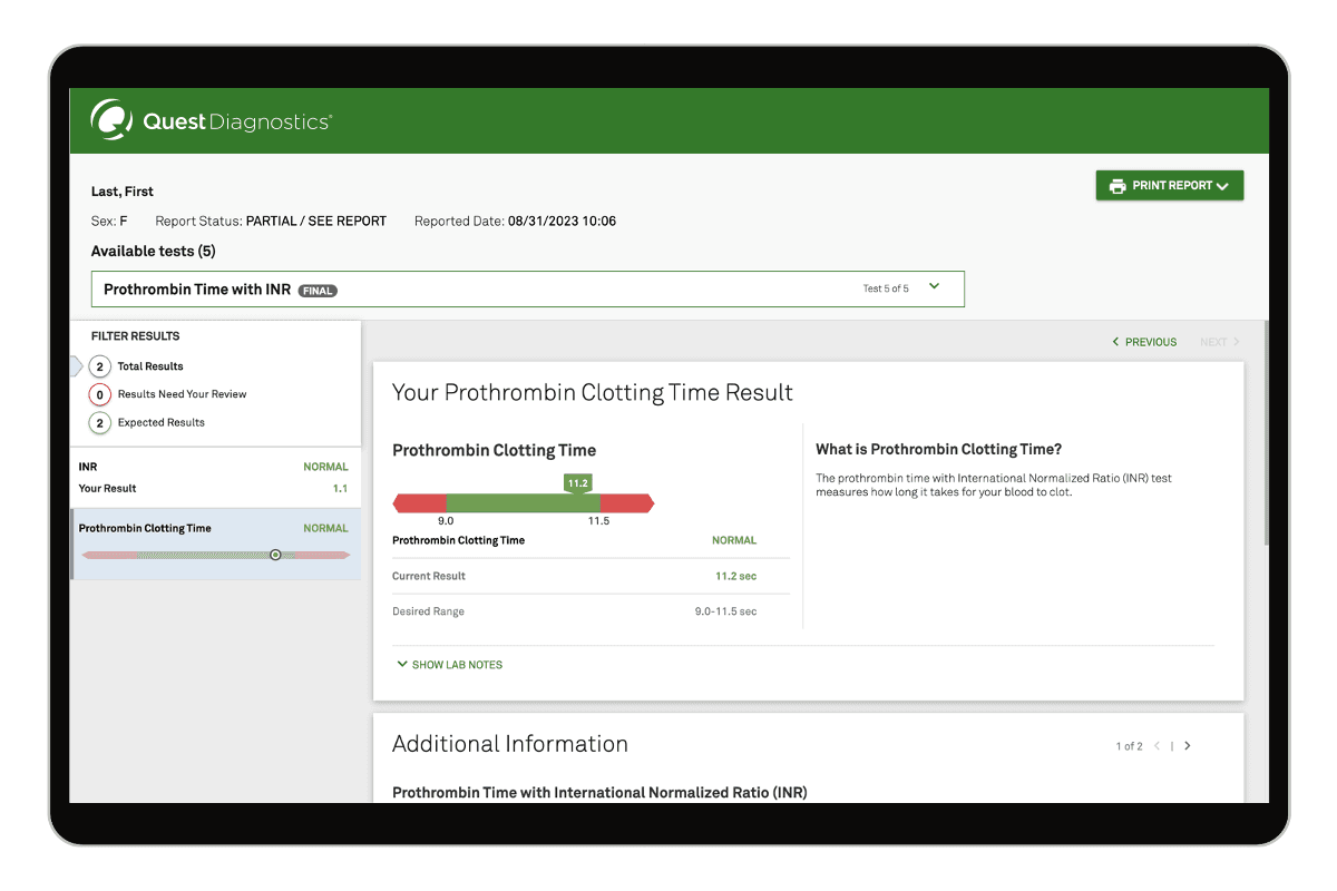 Prothrombin Time with INR