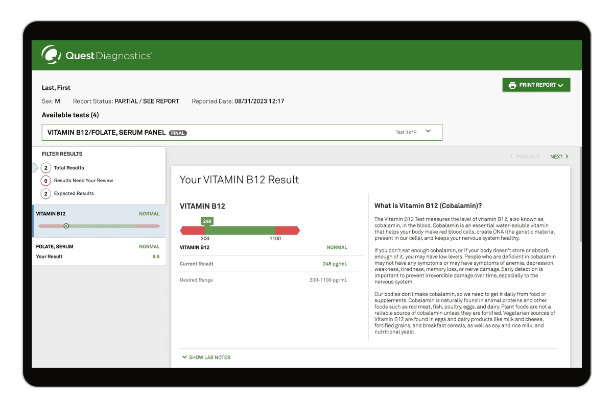 Vitamin B12 & Folate Test