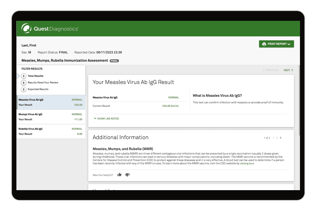 Measles, Mumps, Rubella (MMR) Test