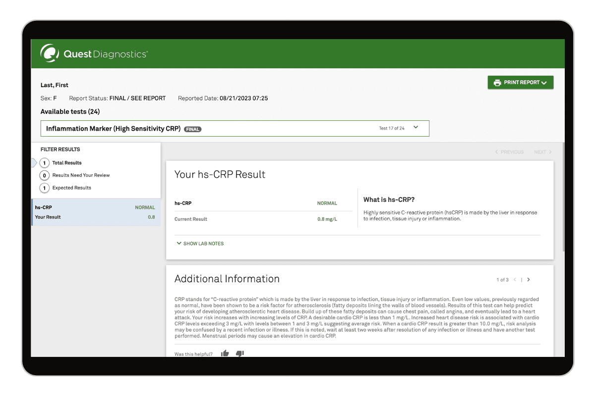 hsCRP Test for Inflammation Marker